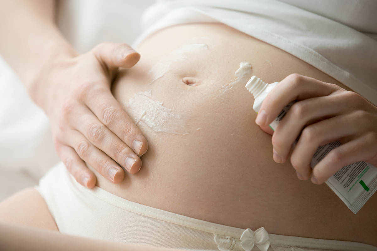 pregnant woman applying stretch mark prevention cream on belly